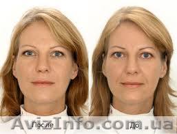 Кислота гиалуроновая - <ro>Изображение</ro><ru>Изображение</ru> #1, <ru>Объявление</ru> #1339557