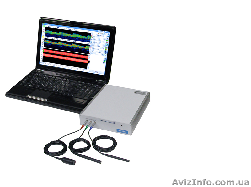 Кардиограф, допплер, энцефалограф, миограф, реограф Кировоград - <ro>Изображение</ro><ru>Изображение</ru> #7, <ru>Объявление</ru> #1048465